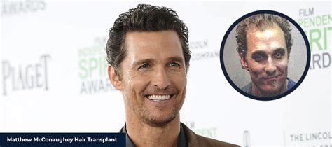 what happened to matthew mcconaughey.